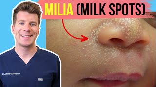 Doctor explains MILIA (aka MILK SPOTS) in babies and infants | Including symptoms and photos