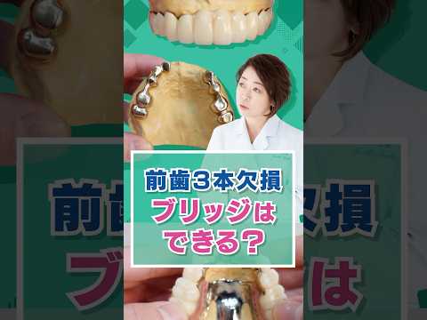 前歯3本欠損、ブリッジはできる？