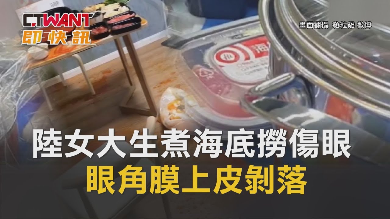 圖說-陸女大生煮海底撈傷眼　眼角膜上皮剝落