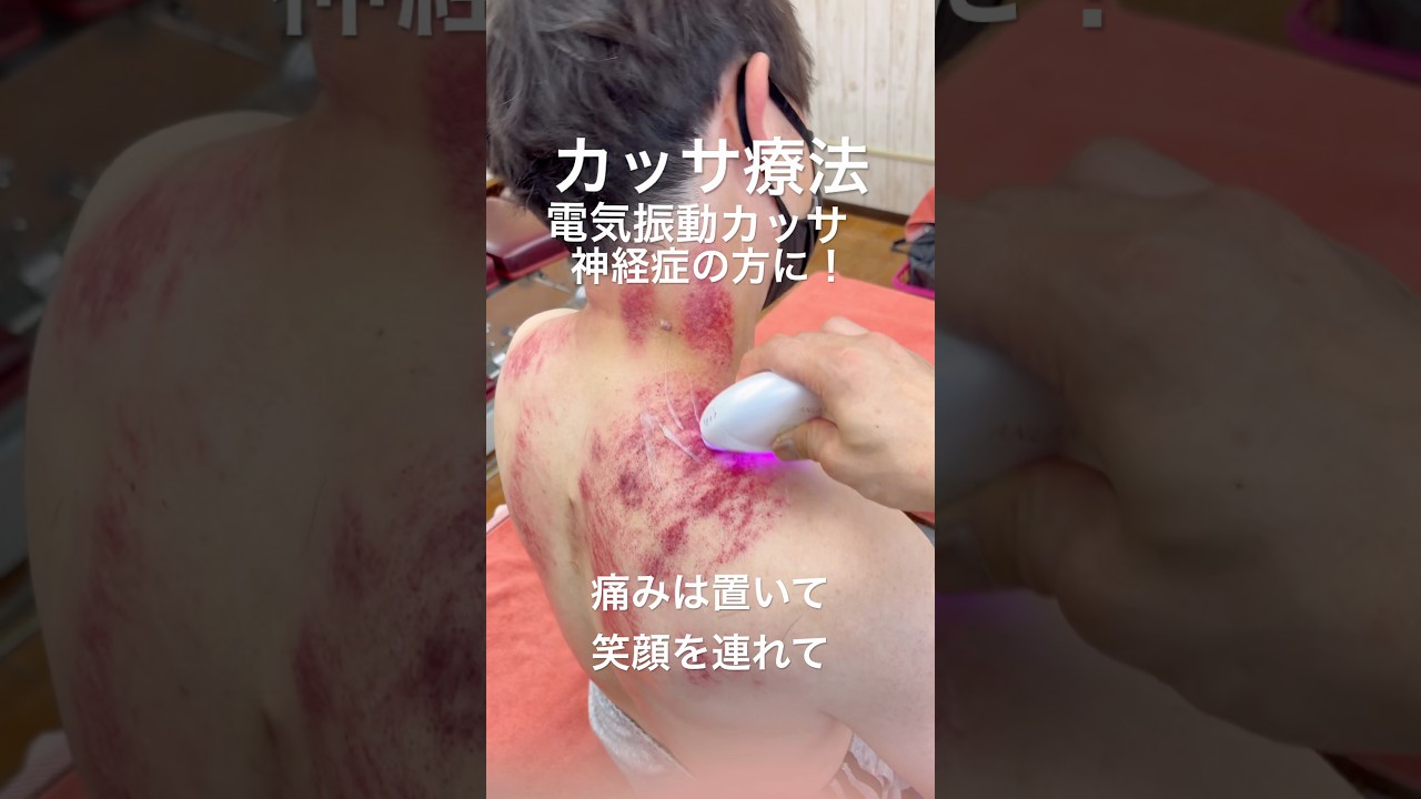 【頸椎神経症に】カッサ療法の進化版！