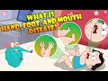 What Is Hand, Foot And Mouth Disease? | Infection In Children | The Dr Binocs Show | Peekaboo Kidz