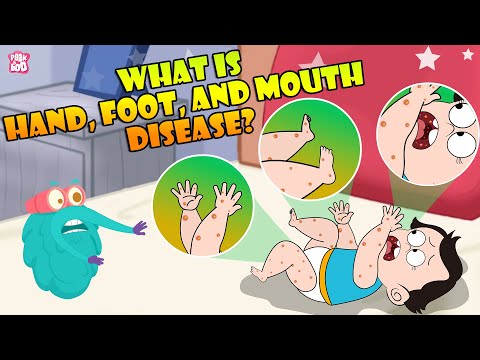 What Is Hand, Foot And Mouth Disease? | Infection In Children | The Dr Binocs Show | Peekaboo Kidz