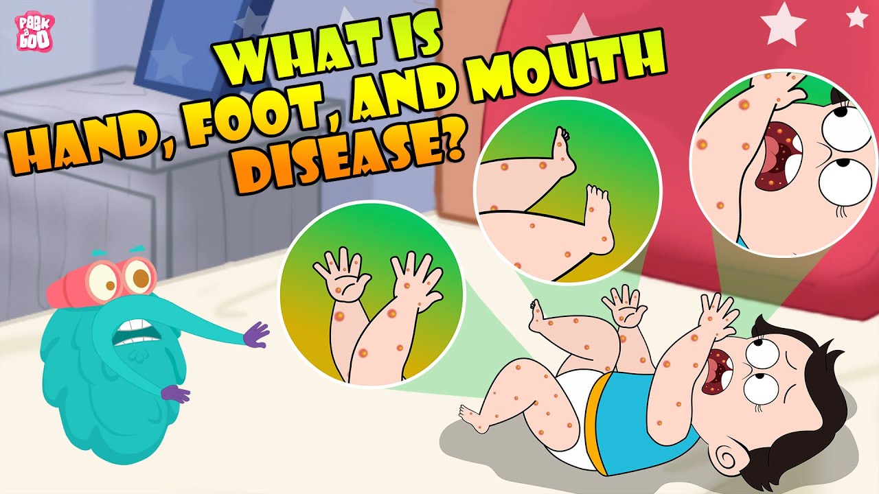 What Is Hand, Foot And Mouth Disease? | Infection In Children | The Dr Binocs Show | Peekaboo Kidz