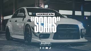 HXRIZXN &quot;Scars&quot; 🩹 | Audio Burial