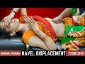 Navel Displacement Constipation Gas And Acidity Abdominal Pain And Swelling Get Fastest Relief