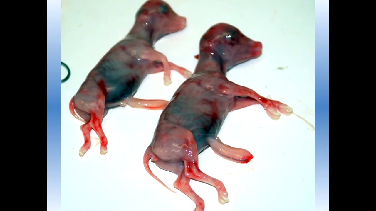 Fetal Sexing