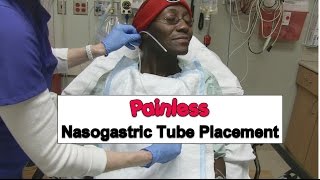 Painless Nasogastric Tube Placement
