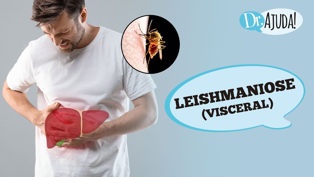 LEISHMANIOSE VISCERAL: O QUE É, SINTOMAS E COMO TRATAR?