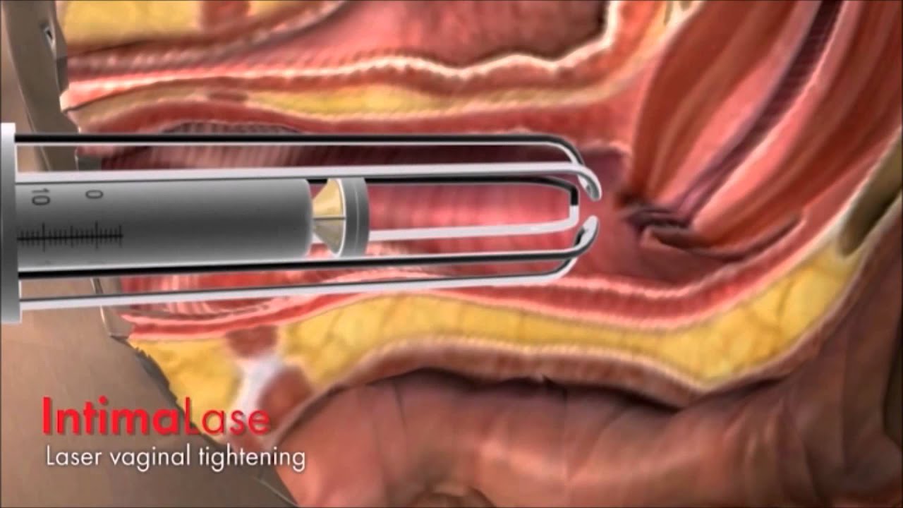 María Isabel Gasca Collado-14