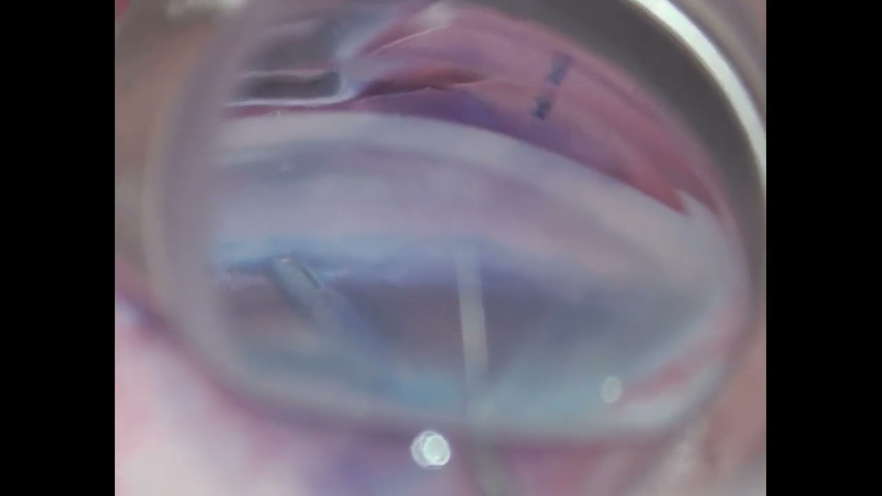 Emanuel Fernando Pandolfo Machado-0