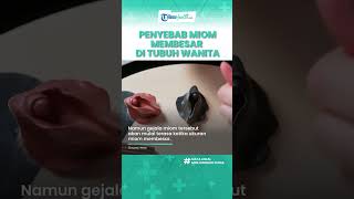 Awas Ukuran Miom Bisa Membesar Tanpa Disadari, Kenali Penyebab Miom Tumbuh di dalam Tubuh Wanita