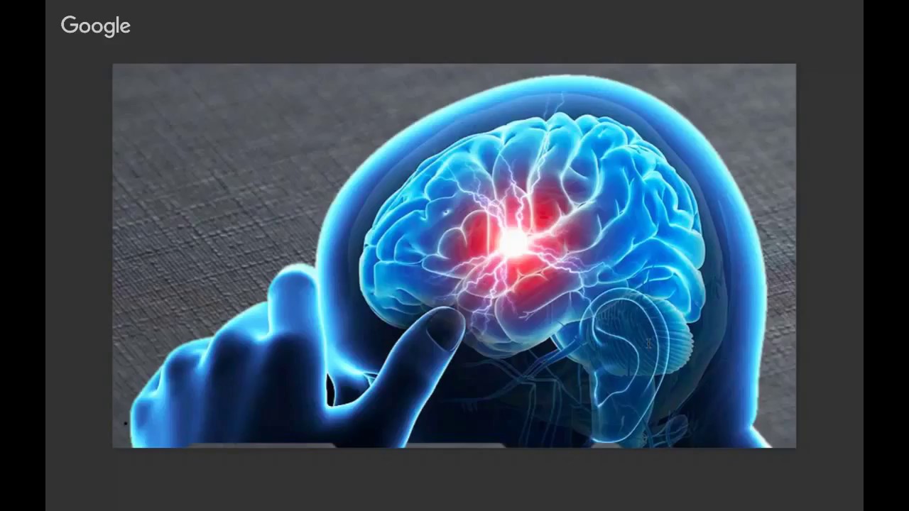 Eclipse Diagnostics Pitching @ StartEngine Demo Day