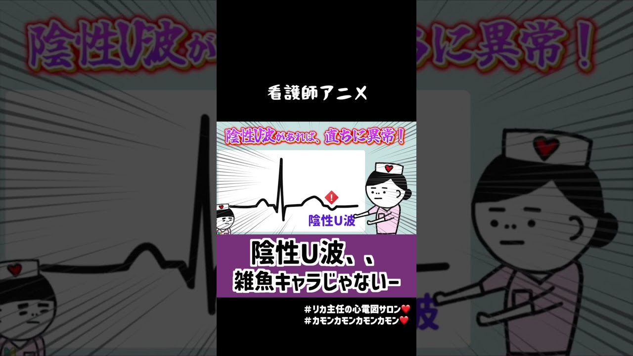 陰性U波は雑魚キャラじゃないー心筋虚血があるかもよー