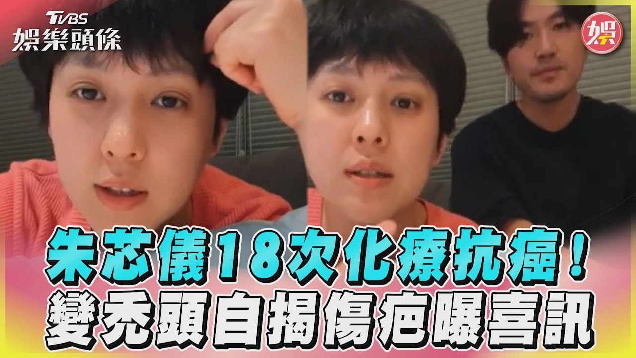 影音/朱芯儀18次化療抗癌! 變禿頭自揭傷疤曝喜訊