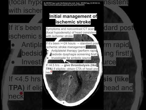 Initial management of ischemic stroke