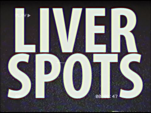LIVER SPOTS