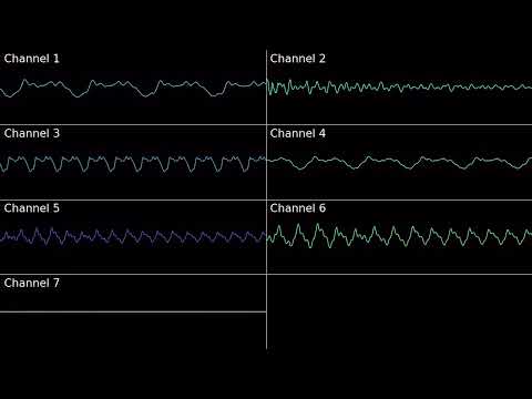 Super Mario Kart - Koopa Beach (Soyo Oka) [SNES osc]