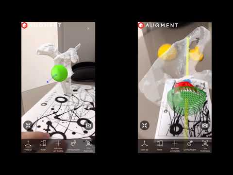 Augmented Reality for Shoulder Surgery
