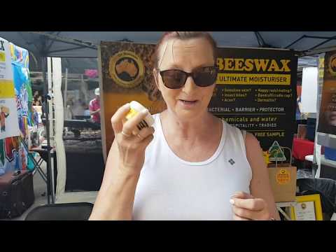 Cracked heels fixed in one week with Oz Beeswax Best Seller!