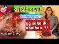 Tanda Dan Gejala Awal Kanker Serviks (Kanker Mulut Rahim) Dan Cara Pencegahannya/Dot Pande Tanda Dan Gejala Awal Kanker Serviks (Kanker Mulut Rahim) Dan Cara Pencegahannya/Dot Pande
