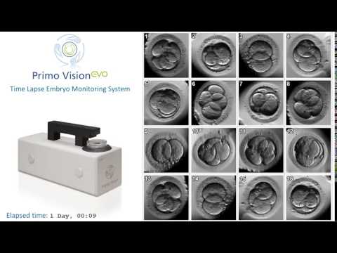 Posmatranje razvoja embriona kamerom Time laps Vitrolife u Bolnici Analife