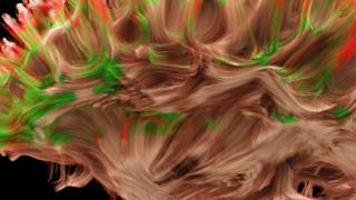 Video:  The most detailed scan of the wiring of a healthy human brain