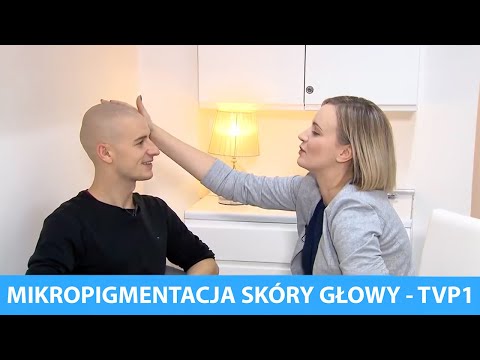 Pryszcze na głowie włosów u mężczyzn leczonych Produkty do włosów i łopian