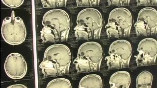 Gesundheit in Nordhessen - Das Neurozentrum