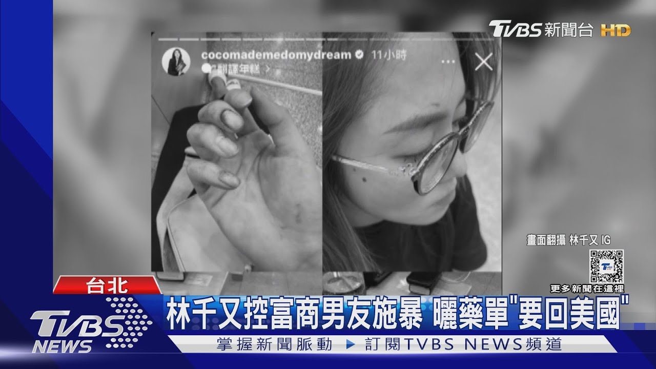 林千又控富商男友施暴　曬藥單認精神有問題「要回美國」