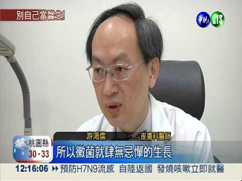 誤當乾癬亂擦類固醇 男全身"長黴"