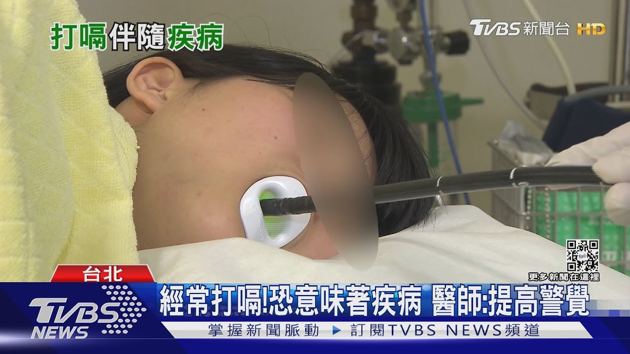 有片／經常打嗝！恐意味著疾病　醫師：提高警覺