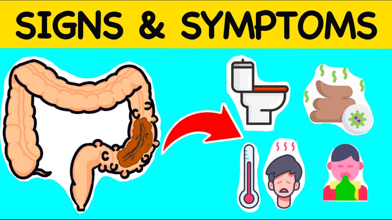 Diverticulitis - You Need To Know These Signs And Symptoms