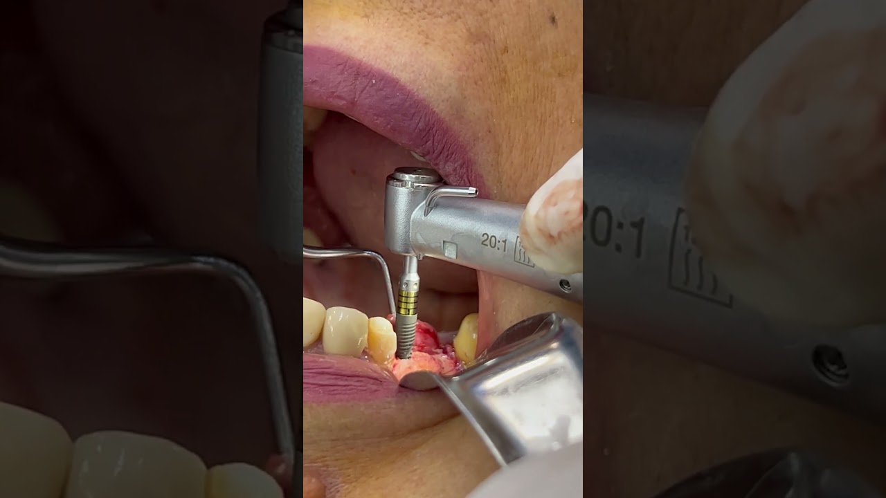 Agustin Salamanca Tapia-31