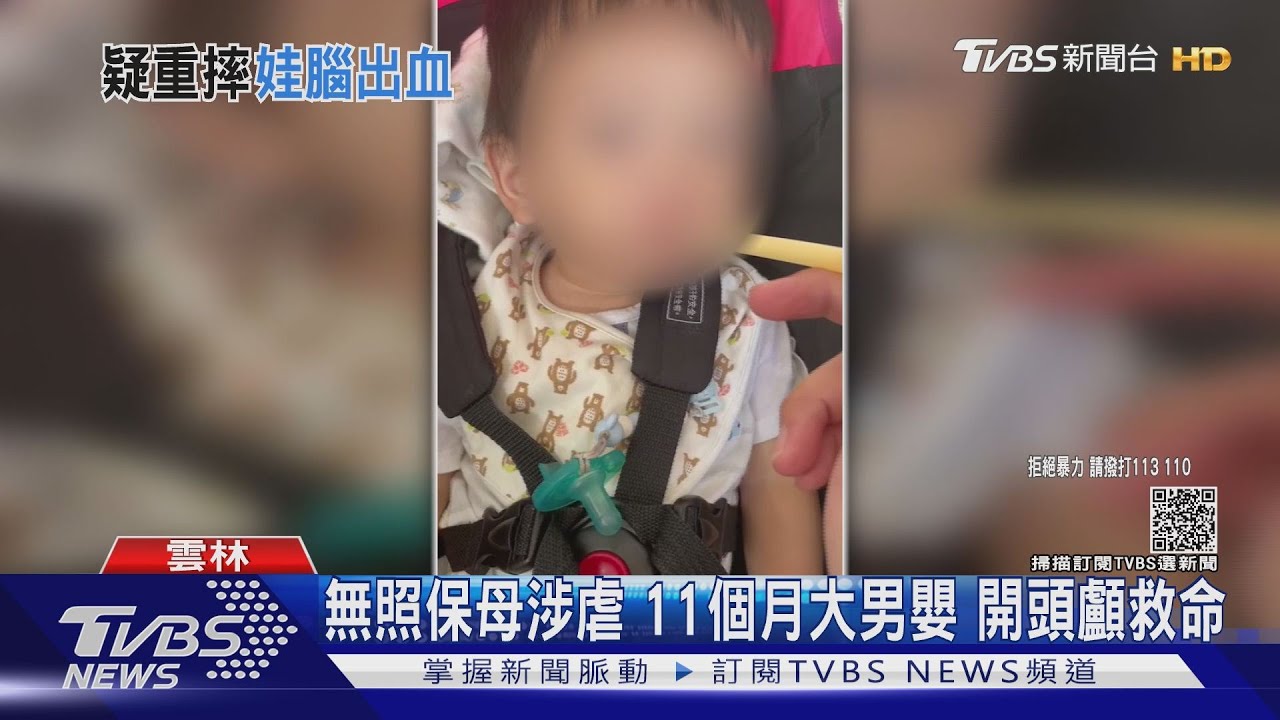 無照保母涉虐11個月大男嬰 開頭顱救命