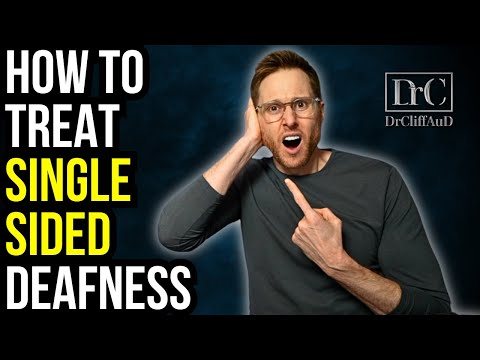 Treating Single Sided Deafness - SSD