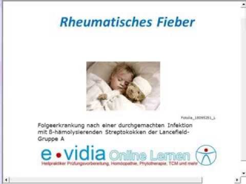 Medizin arthritische Gelenke an den Fingern Schmerzen im Rücken im Unterbauch