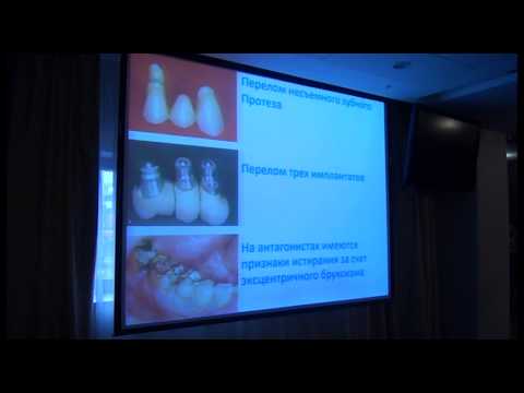 Бруксизм, как фактор риска №1 для стоматологического лечения. Бояться или управлять