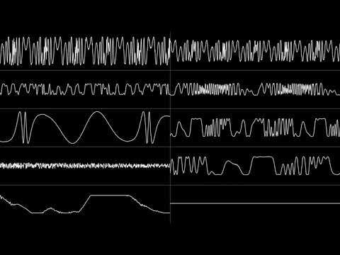 "Black Knight 2000 (Pinball/YM2151+DAC) - Main Theme" [Oscilloscope View]