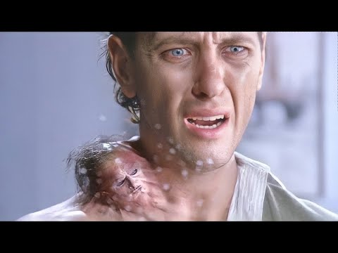 Man Finds A Second Head Growing Up On His Neck And It Wants To Replace Him Permanently