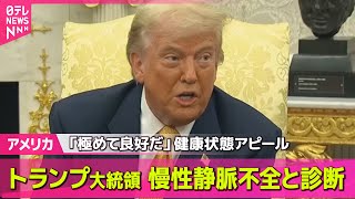 【アメリカ】トランプ大統領、慢性静脈不全と診断される…健康状態は良好/関税交渉どうなる？“キーマン”ベッセント財務長官来日、18日に石破首相と会談へ──国際ニュースライブ （日テレNEWS LIVE）