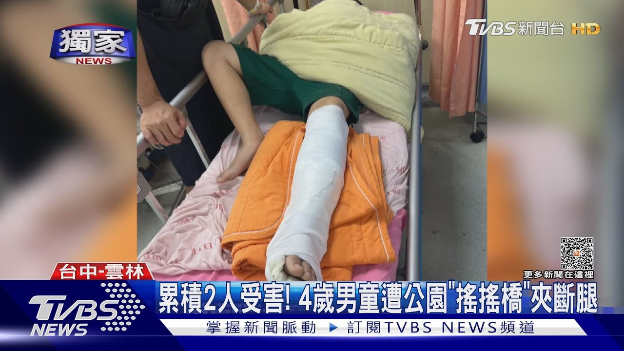 累積2人受害! 4歲男童遭公園「搖搖橋」夾斷腿