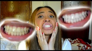 How To Whiten Teeth in 5 Minutes! (Works 100%)