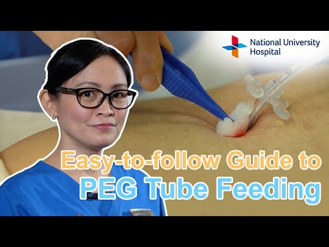Easy-to-follow Guide to PEG Tube Feeding