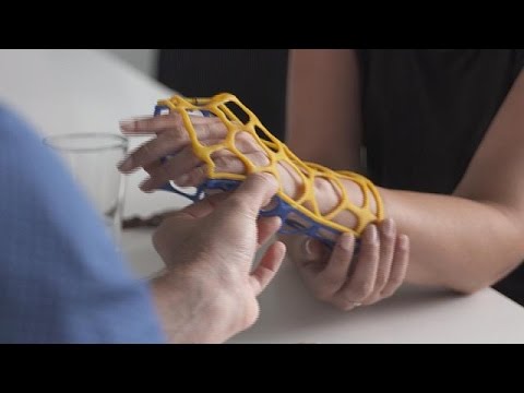 La flessione contrattura dellarticolazione dellanca Proteine di dolori articolari