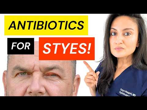 BEST Antibiotic For Stye Treatment | Get Rid Of Eye Stye | Chalazion Medication Ointment #stye