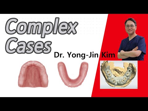 [OneGuide] How to Apply digital Guided Surgery in Complex Cases