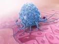 3D Animation How Our Wounds Heal
