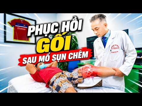 Phục Hồi Sau Mổ Sụn Chêm: Sai Lầm Khiến Gối Lâu Lành
