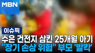 수은 건전지 삼킨 25개월 아기…＂장기 손상 위험＂ 부모 '발칵' | 이슈픽