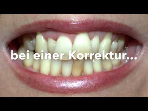 GYN wund unteren Rücken Schmerzen in der linken Seite des Rückens